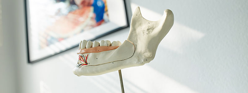 Erkrankten Zahn erhalten mit Wurzelbehandlung in Coesfeld